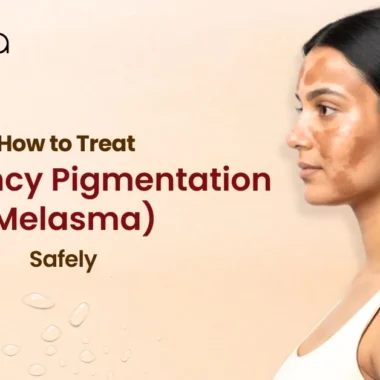 How to manage oily skin and breakouts during pregnancy